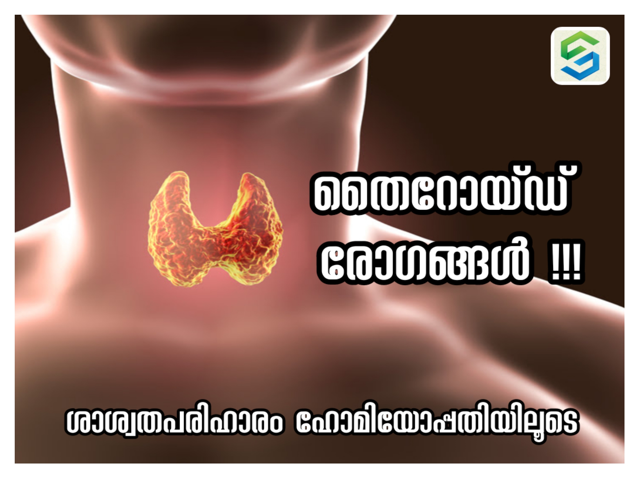 SAM SAM HOMEOPATHY MANNARKKAD